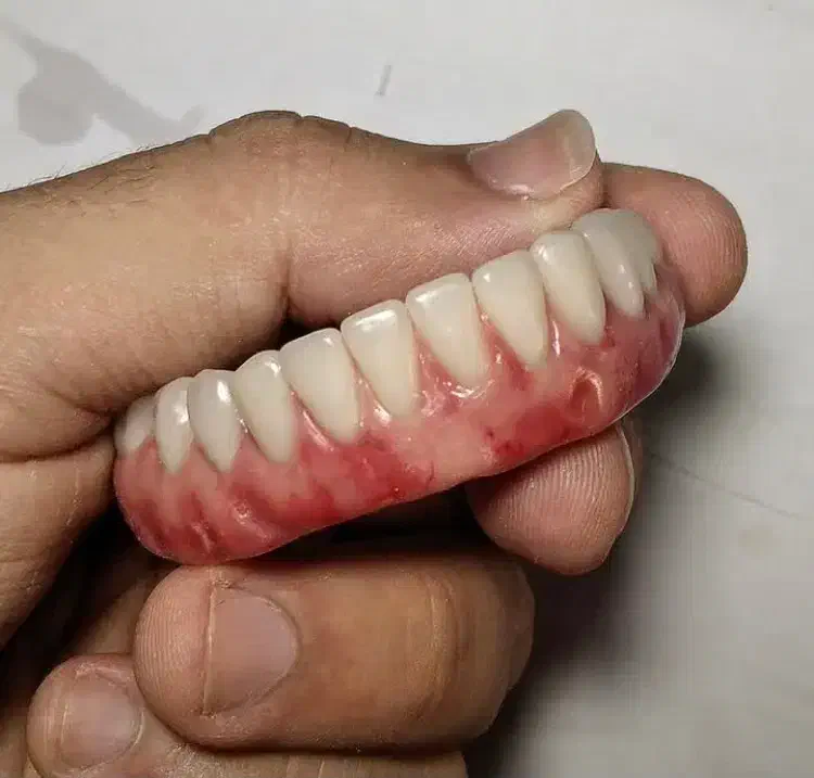 ساخت دندان متحرک|خدمات آرایشگری و زیبایی|شوش, |دیوار