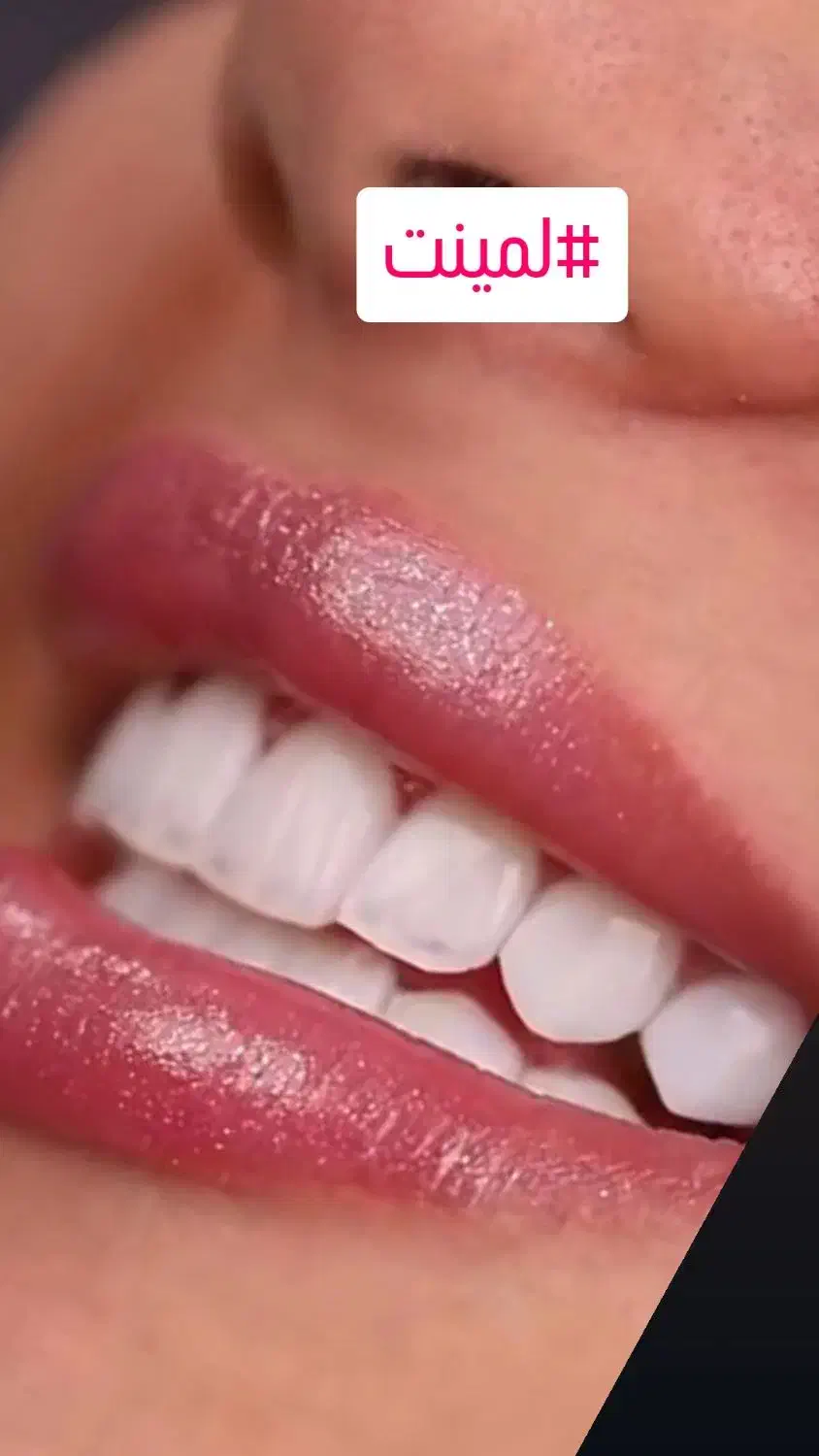 دندانپزشکی.لمینت.ایمپلنت.|خدمات آرایشگری و زیبایی|اصفهان, جلفا|دیوار