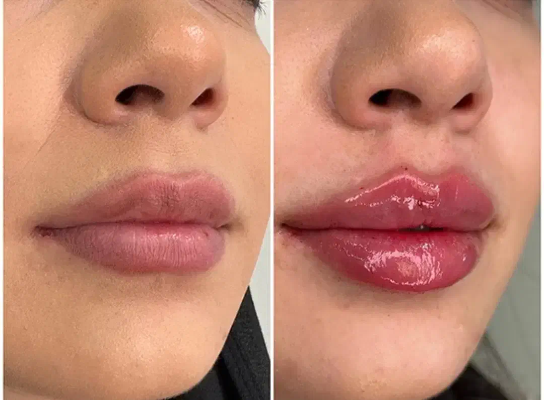 تخفیف ژل و بوتاکس ویژه فقط برای فردا|خدمات آرایشگری و زیبایی|مشهد, شهید معقول|دیوار