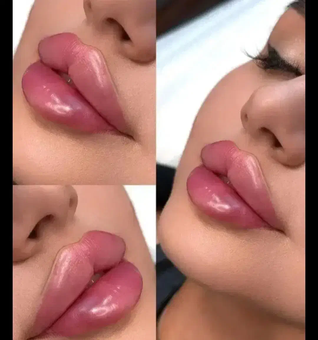 خدمات ژل فیلربوتاکس مزوژل درکلینیک با اف ویژه|خدمات آرایشگری و زیبایی|زاهدان, |دیوار