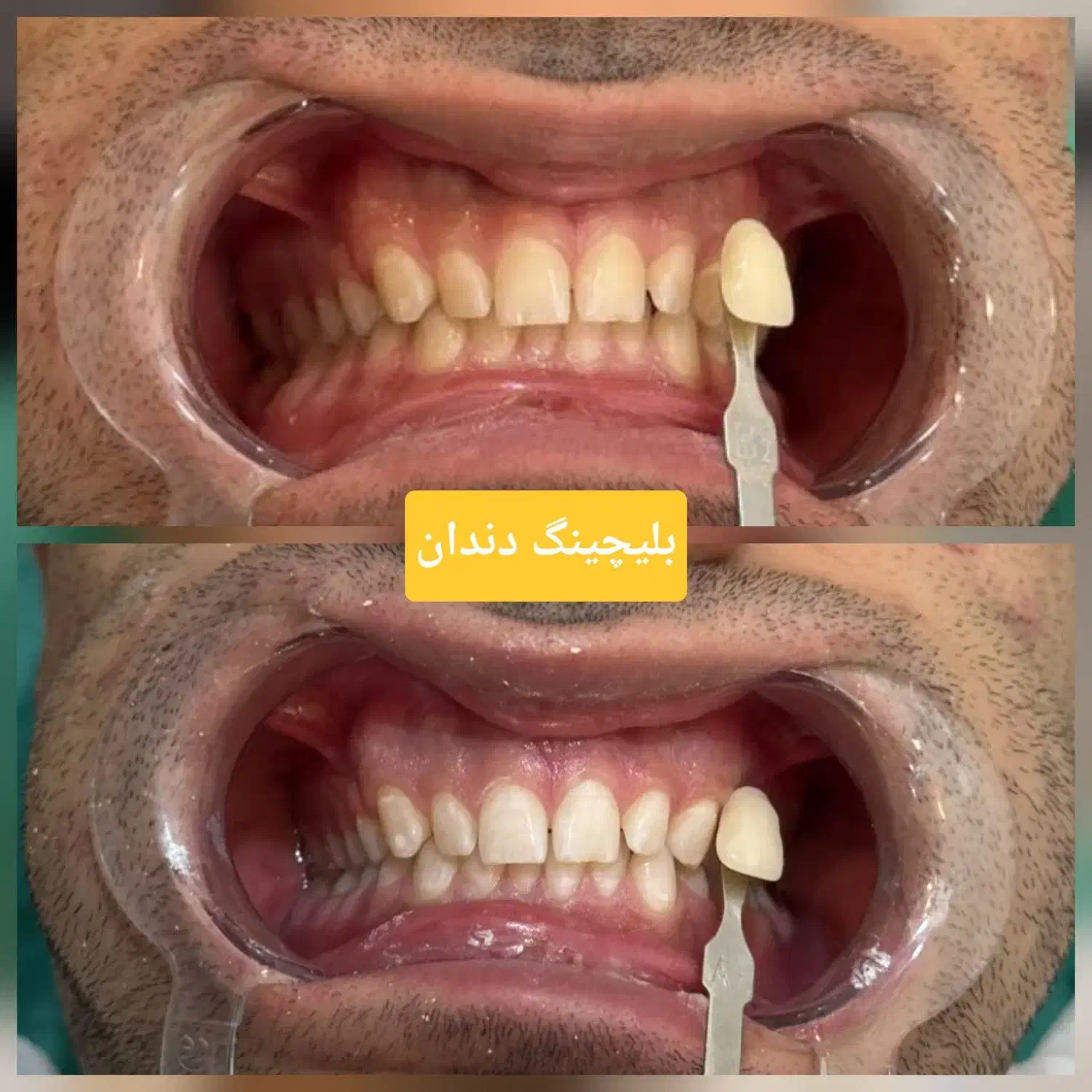 دندانپزشکی دکتر رضوی|خدمات آرایشگری و زیبایی|قم, چهار امامزاده|دیوار