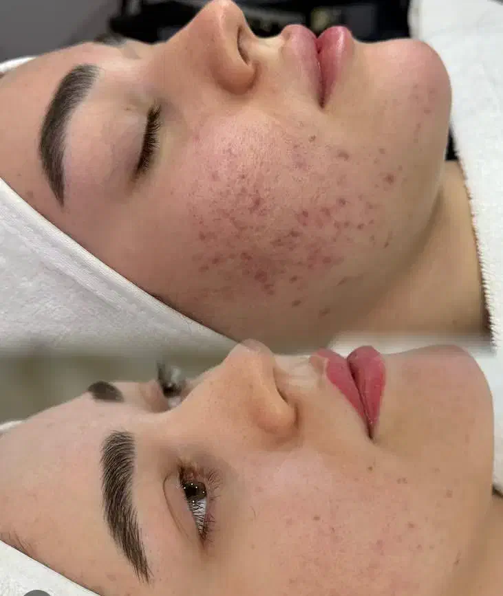 فشیال تخصصی ودرمانی|خدمات آرایشگری و زیبایی|رفسنجان, |دیوار