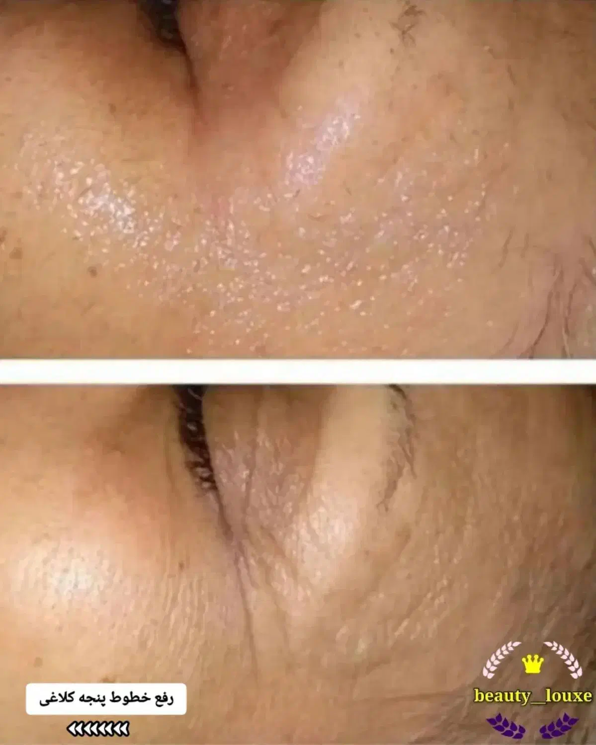 مراقبتی و ارایشی|آرایشی، بهداشتی، درمانی|جوانرود, |دیوار