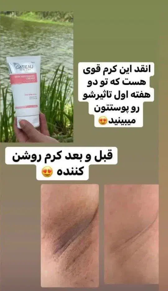 لوازم آرایشی و بهداشتی اصل با قیمت ویژه|آرایشی، بهداشتی، درمانی|تهران, چیتگر جنوبی|دیوار