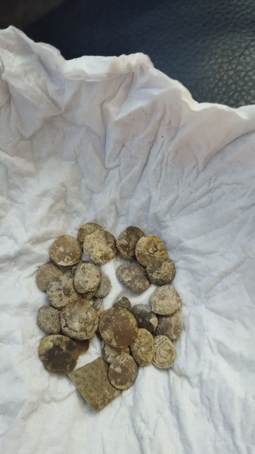 سنگهای قدیمی|کلکسیون اشیاء عتیقه|چرداول, |دیوار