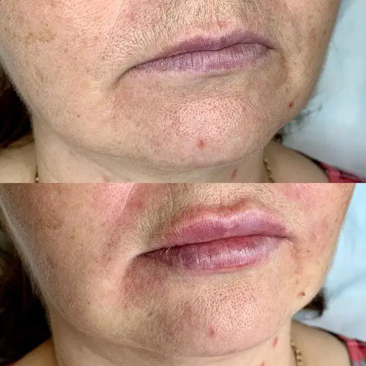 جشنواره آموزشی فیلر نخ بوتاکس زیر نظر دکتر...|خدمات آموزشی|تهران, قلهک|دیوار