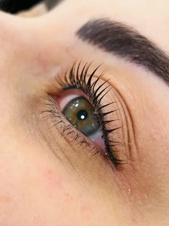 آموزش لیفت فقط با ۲۸۰۰|خدمات آموزشی|بندرعباس, |دیوار