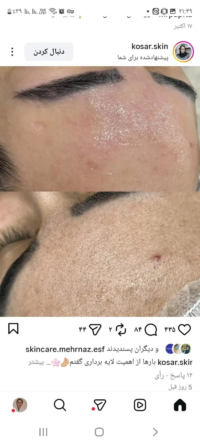 آموزش تخصصی پاکسازی پوست|خدمات آموزشی|کرمان, |دیوار