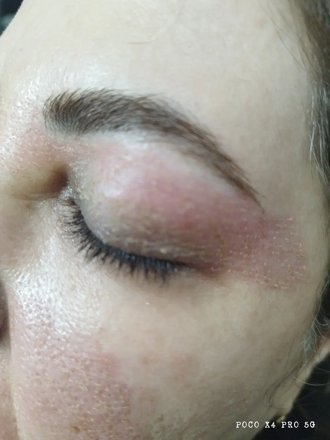 پلاسما پلکسر وقیمت باورنکردنی ۲۰۰هزار|خدمات آرایشگری و زیبایی|تهران, ارامنه|دیوار