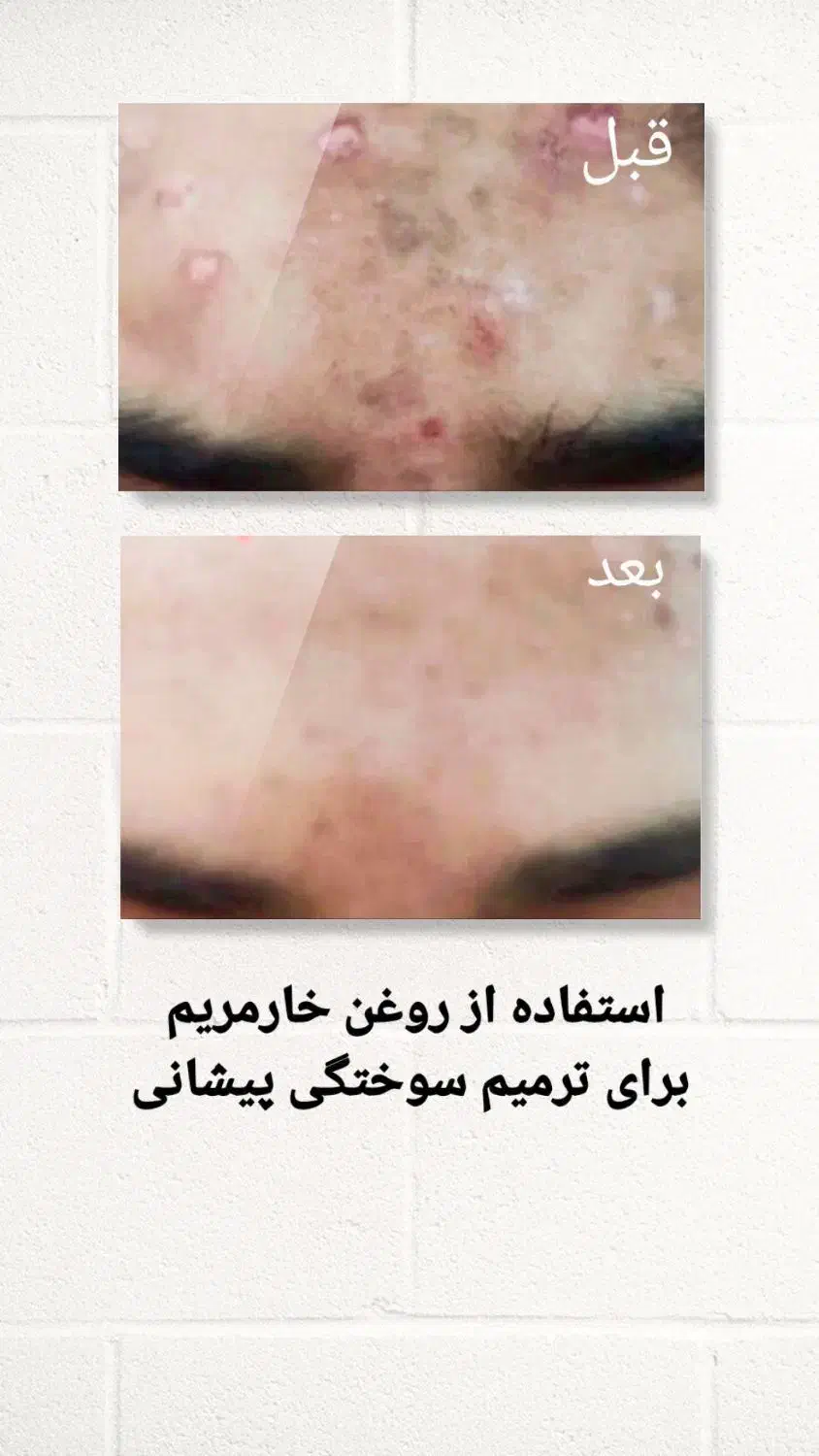 درمان از دل طبیعت|آرایشی، بهداشتی، درمانی|حمیدیه, |دیوار