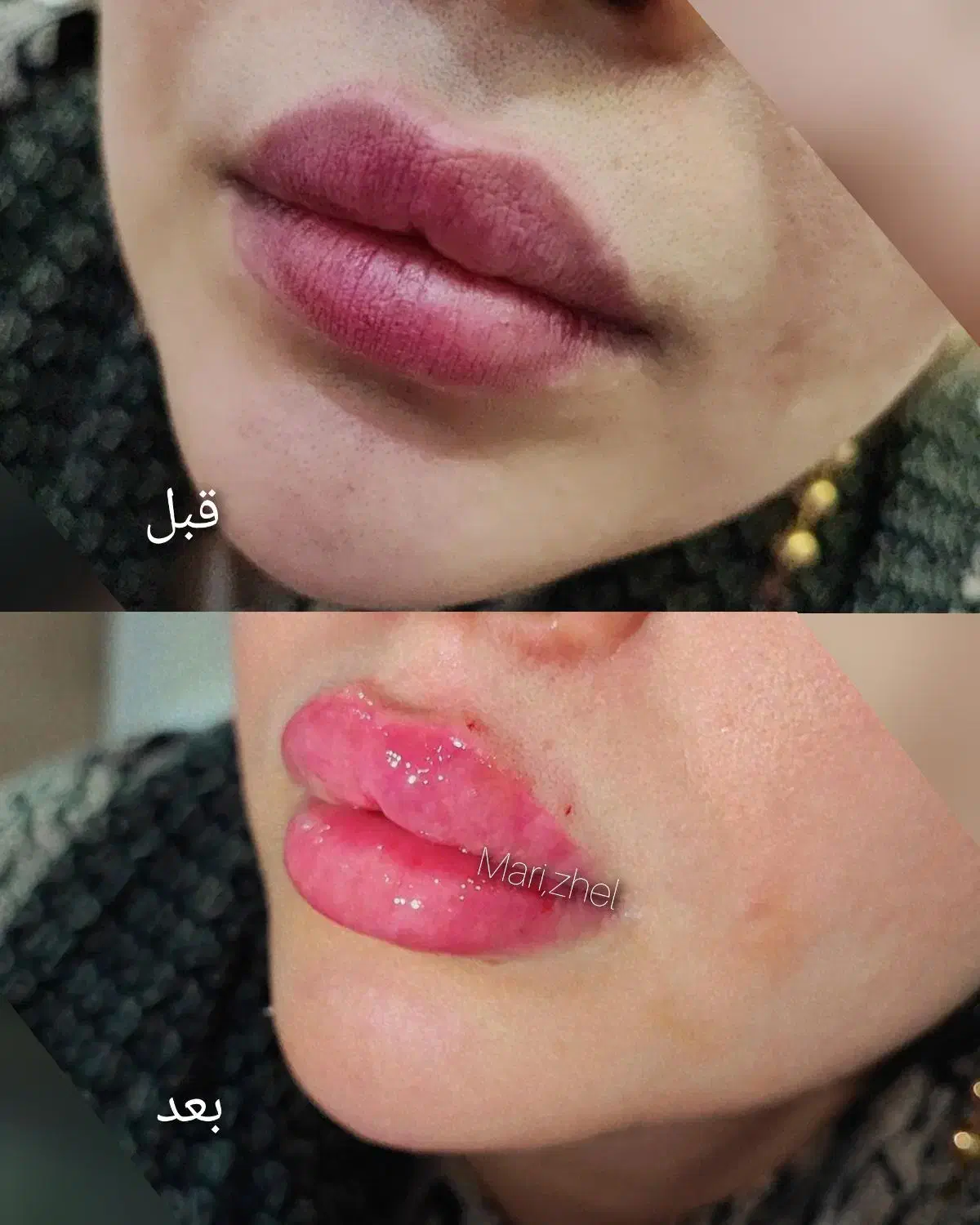 تزریق ژل بوتاکس چال گونه تتو پرسینگ مژه و اموزش|خدمات آرایشگری و زیبایی|اهواز, معین زاده|دیوار