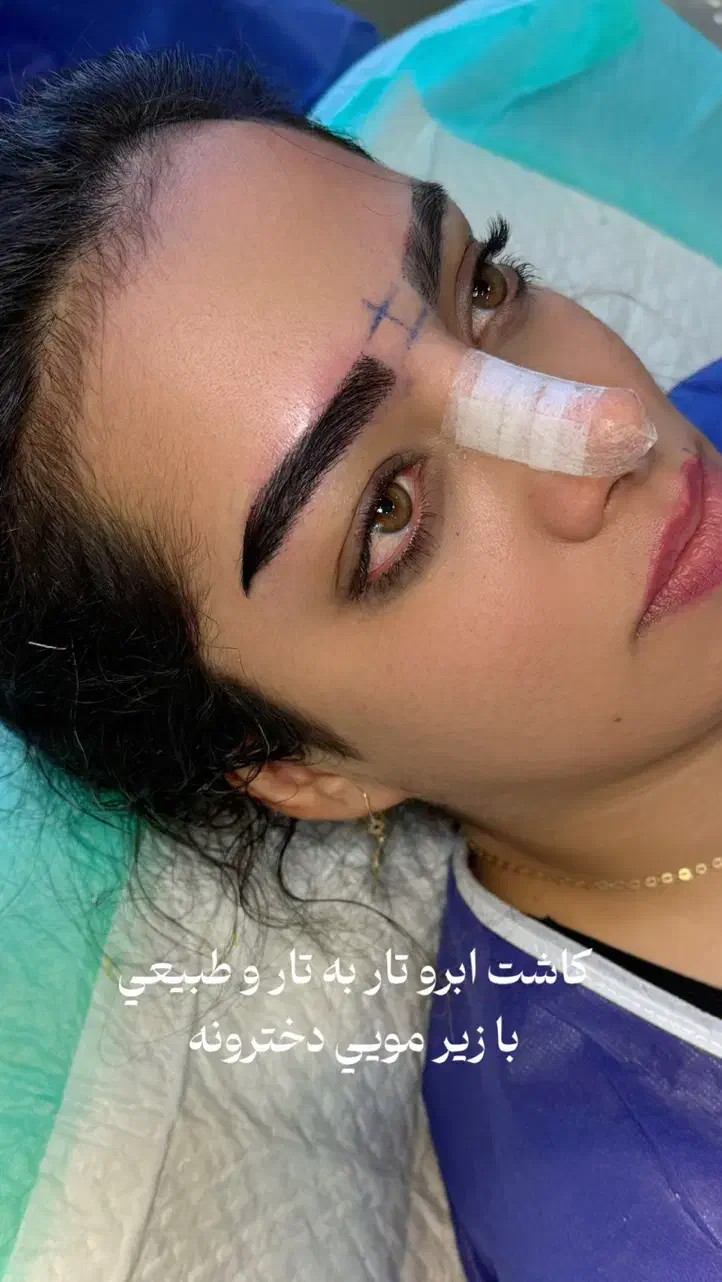 کاشت ابرو دائمی بدون بخیه بدون برش با خواب طبیعی|خدمات آرایشگری و زیبایی|تبریز, |دیوار