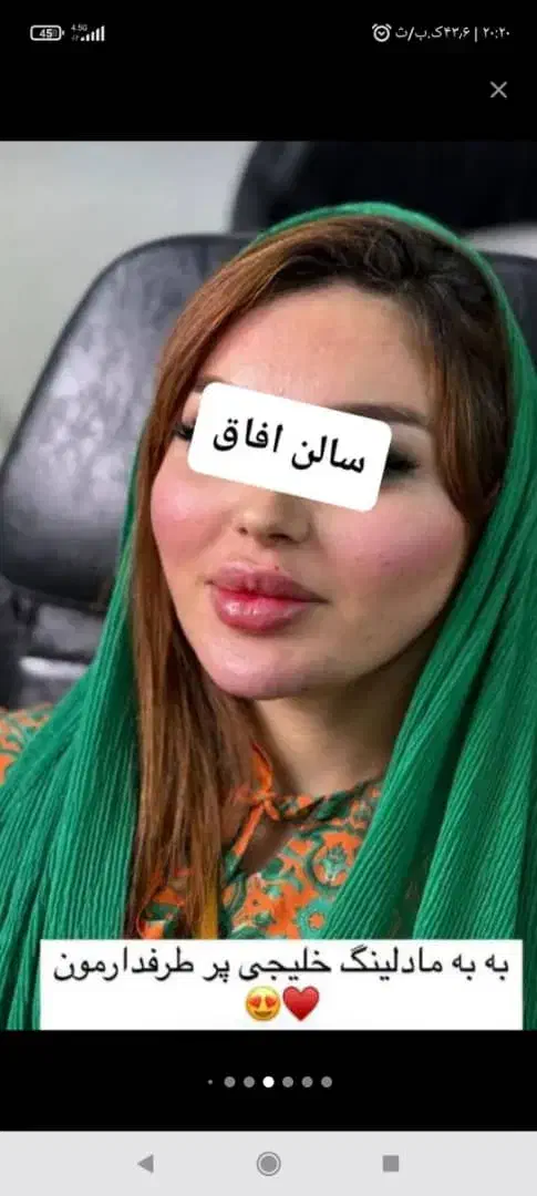 آف محدود ژل و بوتاکس فقط سی سی۴۵۰تا آخر هفته|خدمات آرایشگری و زیبایی|اهواز, پردیس|دیوار