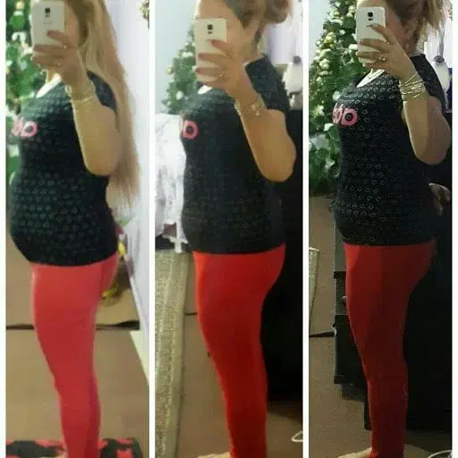 درمان چاقی و لاغری و ماساژ|آرایشی، بهداشتی، درمانی|تبریز, |دیوار