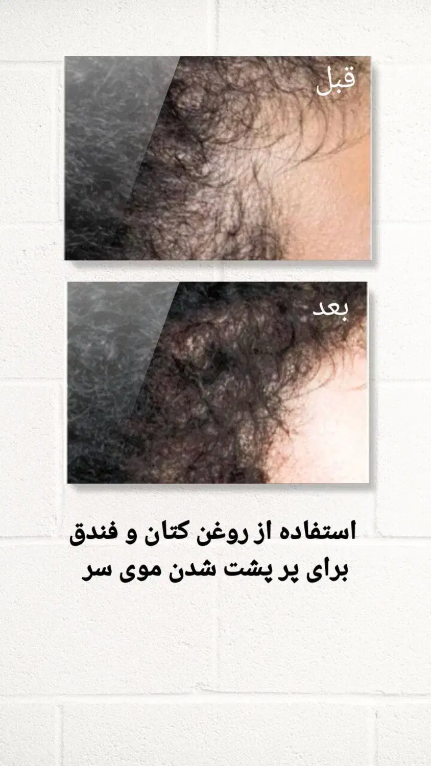 درمان اصلی ریزش مو|آرایشی، بهداشتی، درمانی|شوشتر, |دیوار