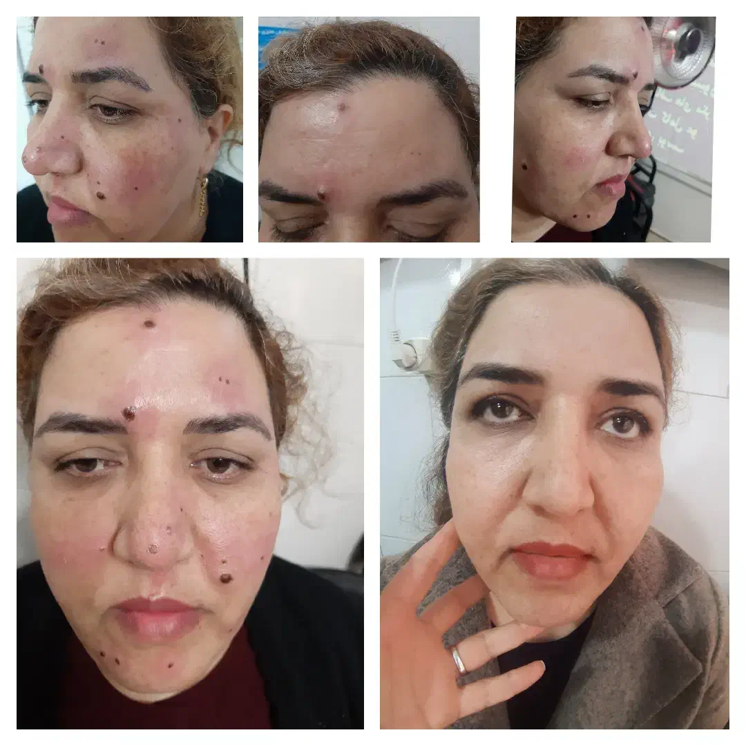 پوست ،زیبایی|خدمات آرایشگری و زیبایی|رباط‌کریم, الارد|دیوار