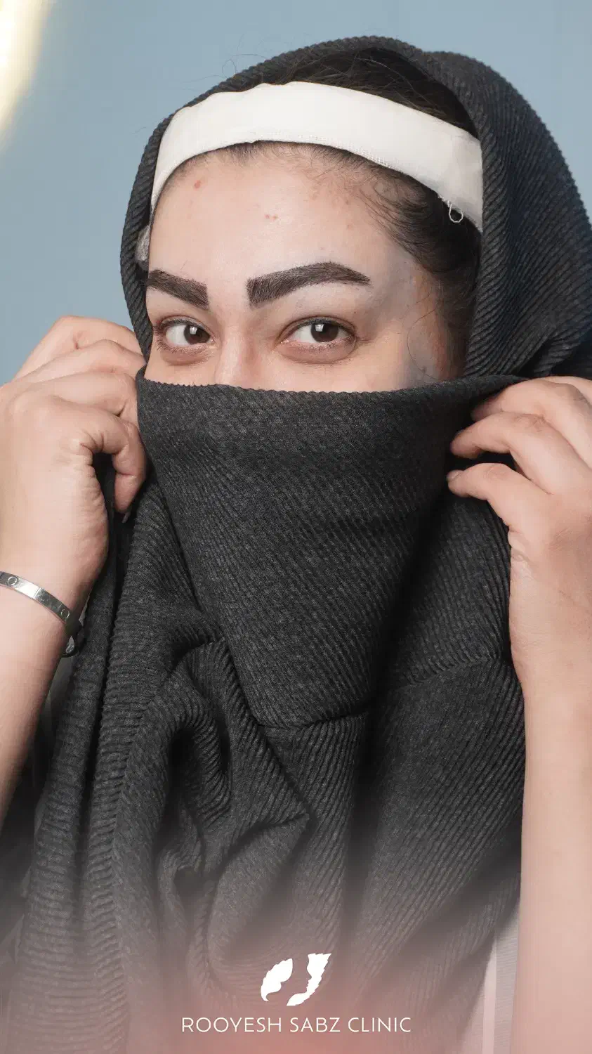 کاشتمو و ابرو|خدمات آرایشگری و زیبایی|تهران, جردن|دیوار