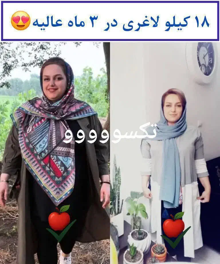 آگهی لاغری|آرایشی، بهداشتی، درمانی|گرگان, |دیوار