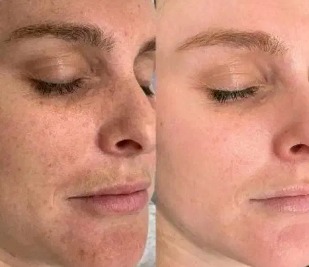 کرم سفیدکننده پوست وضدلک قوی گلدن کویین|آرایشی، بهداشتی، درمانی|مرودشت, مسجد رسول|دیوار