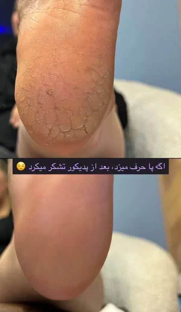 آموزش پدیکور|خدمات آموزشی|بروجرد, |دیوار