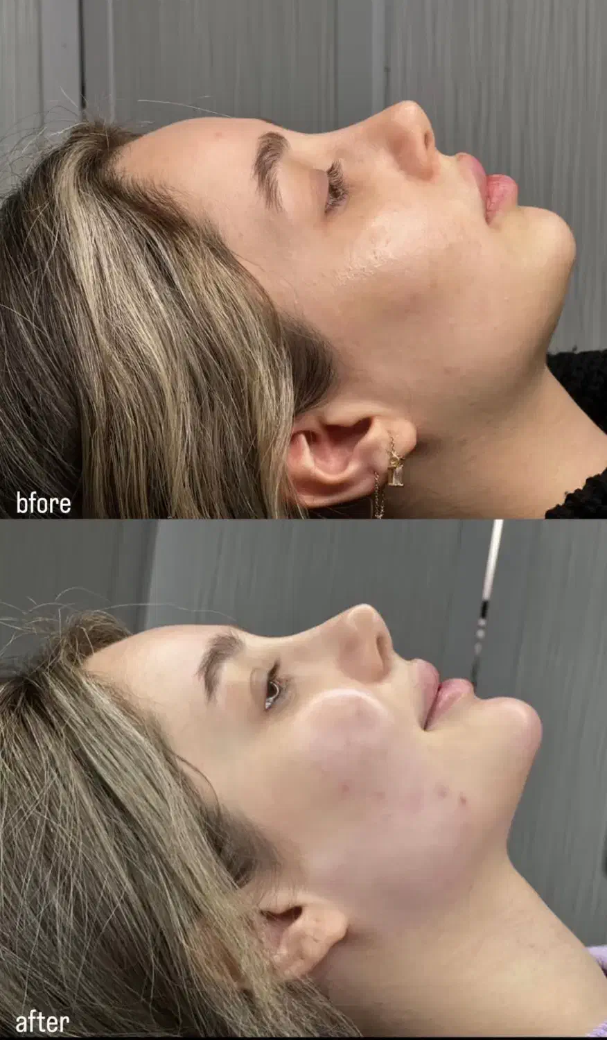 جشنواره تخفیف ژل لب و بوتاکس|خدمات آرایشگری و زیبایی|کرج, خرمدشت|دیوار