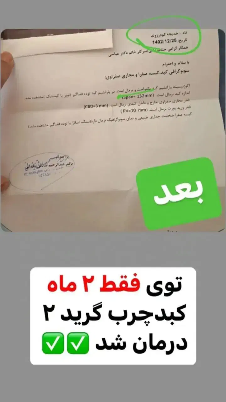 اگه درگیر کبد چرب هستی پیام بده|آرایشی، بهداشتی، درمانی|امامزاده عبدالله, |دیوار