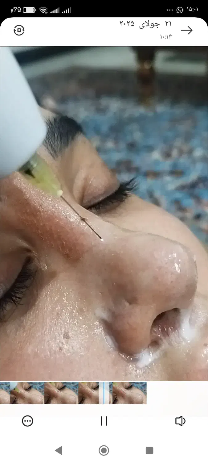 پلاسما پلکسر وقیمت باورنکردنی ۲۰۰هزار|خدمات آرایشگری و زیبایی|تهران, ارامنه|دیوار