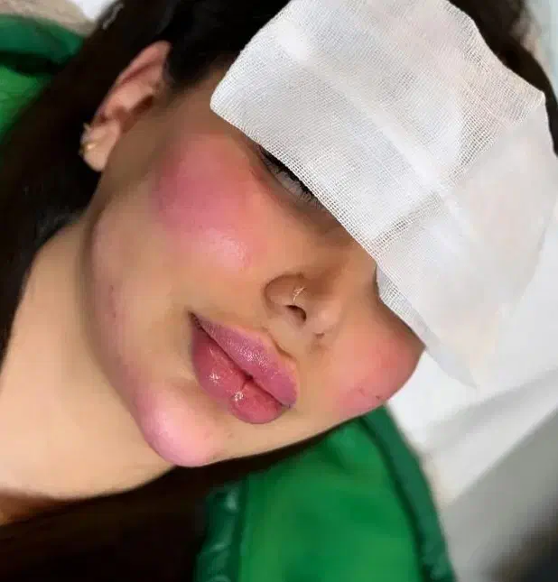 ژل و چربی|خدمات آرایشگری و زیبایی|ایلام, |دیوار