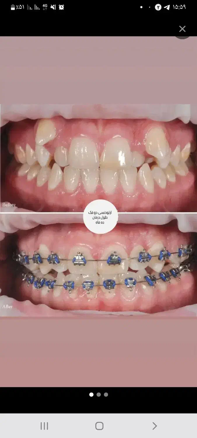 دندون پزشکی|پزشکی|یاسوج, |دیوار