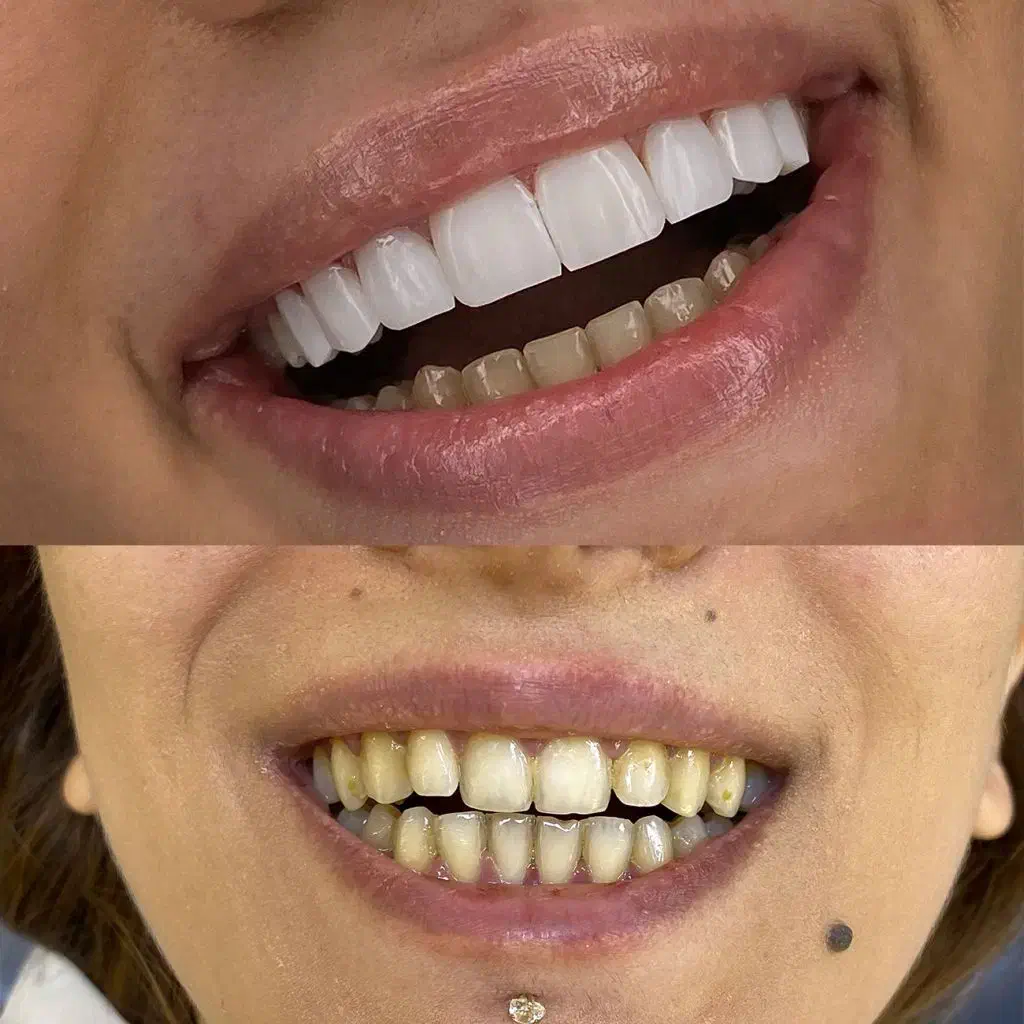 کامپوزیت آف ویژه|خدمات آرایشگری و زیبایی|بروجرد, |دیوار