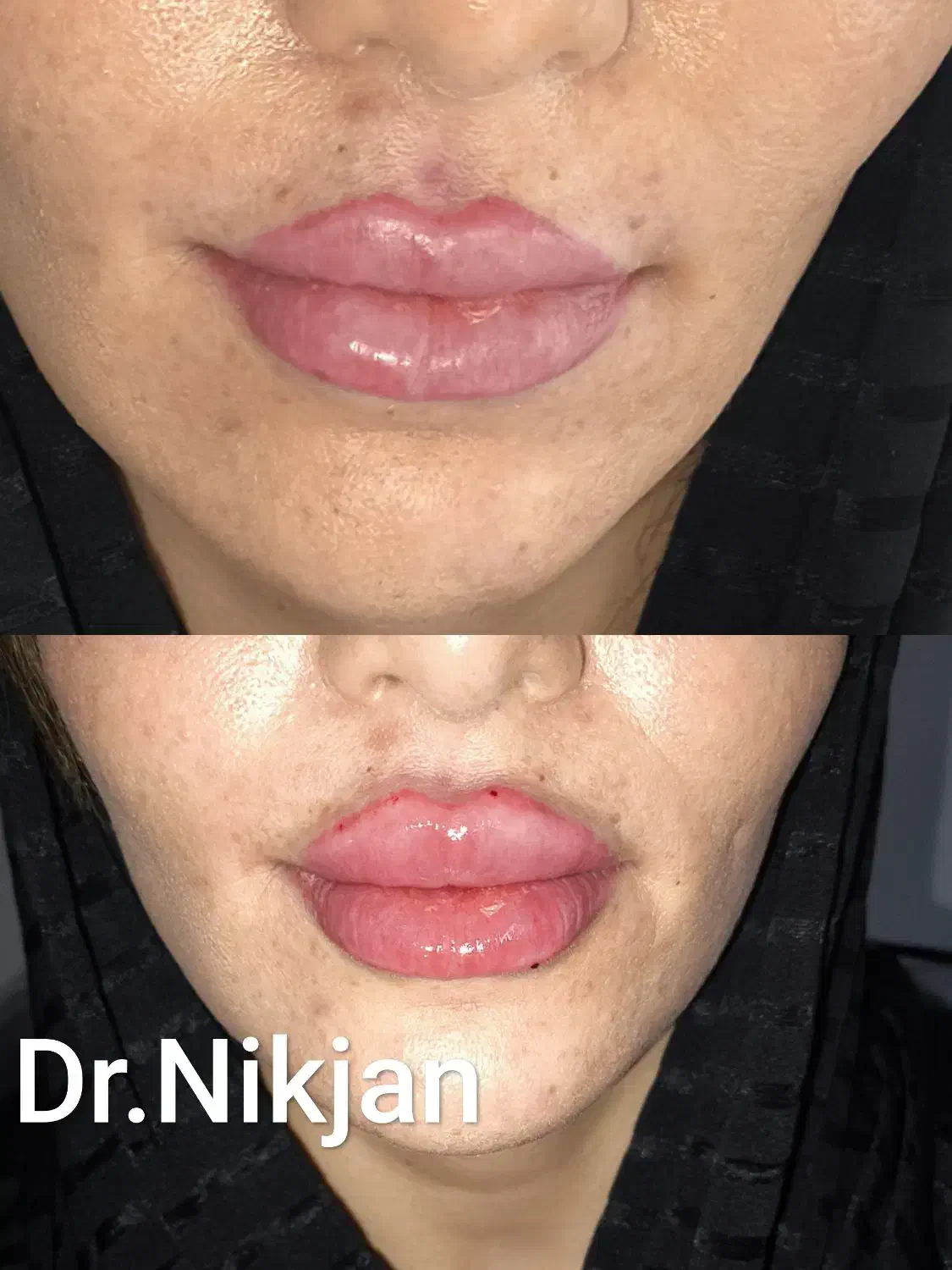 تخفیف ویژه افتتاحیه کلینیک زیبایی دکتر نیک جان|خدمات آرایشگری و زیبایی|رشت, گلسار|دیوار