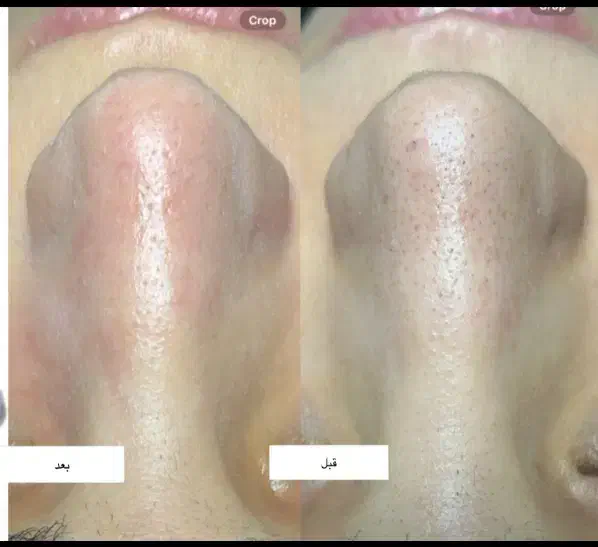 آفر عیدانه|خدمات آرایشگری و زیبایی|قزوین, |دیوار