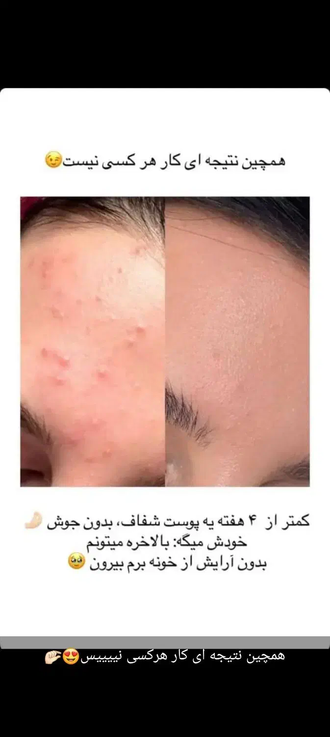 کرم شب آیسل پلاس|آرایشی، بهداشتی، درمانی|ایرانشهر, |دیوار