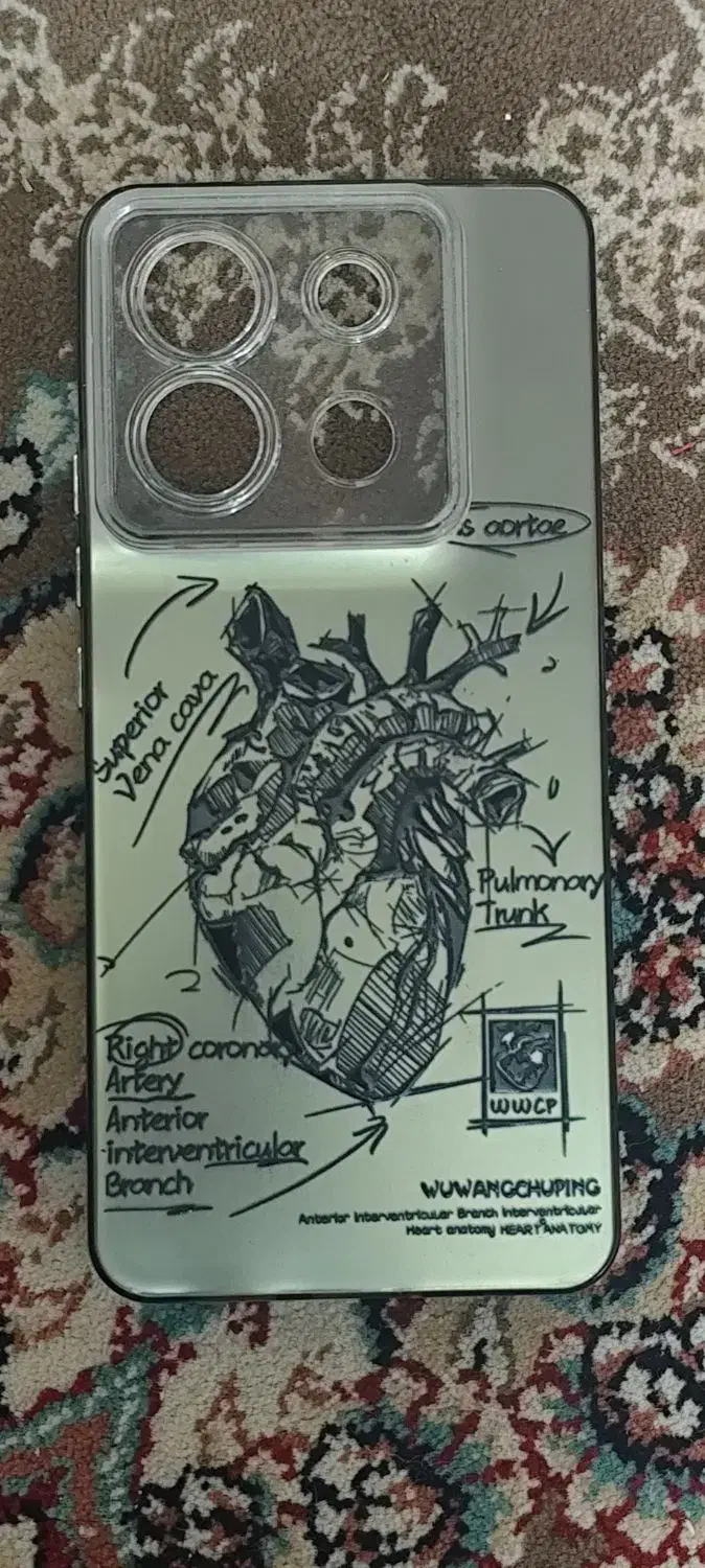 قاب نوت ۱۳پرو۵جی|لوازم جانبی موبایل و تبلت|سبزوار, پاسداران|دیوار