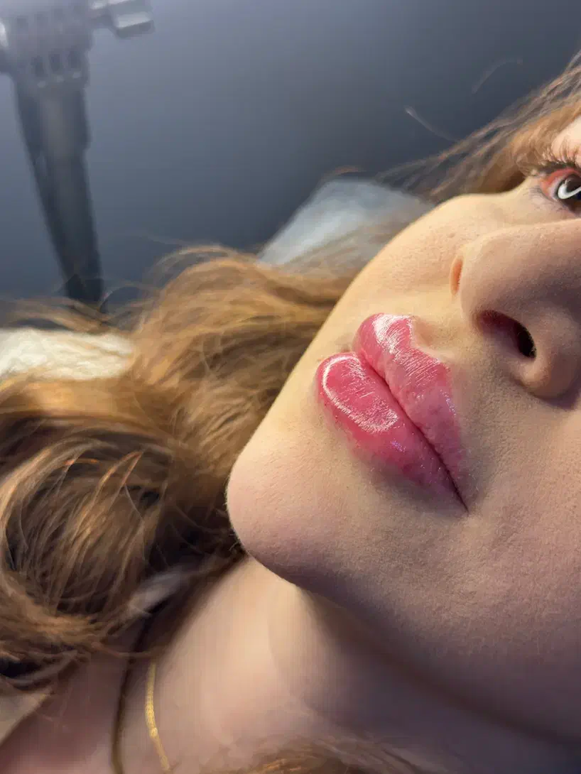 ژل و بوتاکس آموزش|خدمات آموزشی|تهران, کیانشهر|دیوار