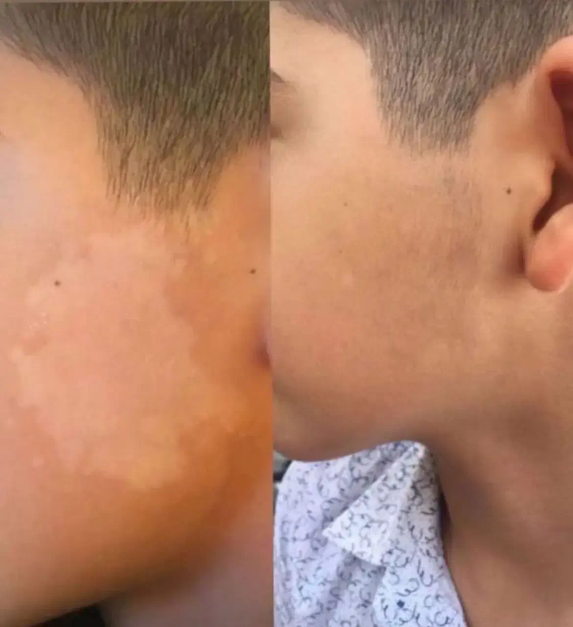 درمان مشکلات پیسی و پسوریازیس|آرایشی، بهداشتی، درمانی|اهواز, غیزانیه|دیوار