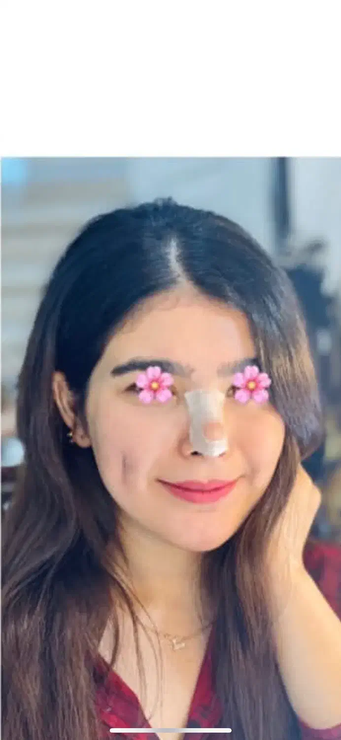 پیرسینگ کل بدن و چال گونه دائم با نخ (۸سال سابقه|خدمات آرایشگری و زیبایی|تربتحیدریه, کاشانی|دیوار