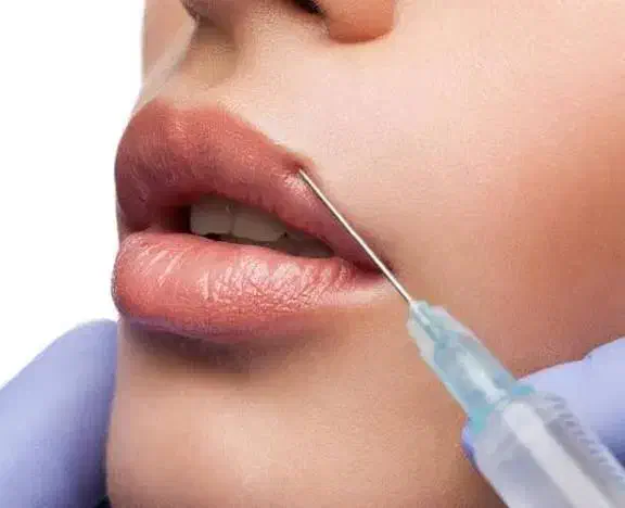 مدل برای تزریق فیلر توسط پزشک|خدمات آرایشگری و زیبایی|ساری, |دیوار
