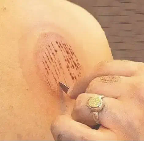 اصلاح لگن، حجامت، مشاوره سلامت|خدمات آرایشگری و زیبایی|قم, در بهشت|دیوار