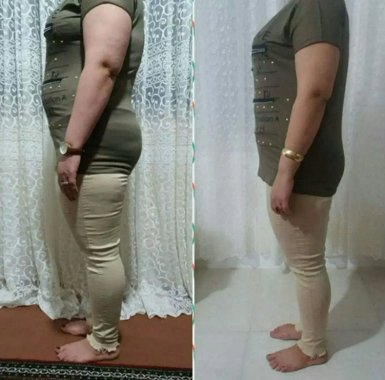 درمان چاقی|آرایشی، بهداشتی، درمانی|کوهدشت, |دیوار