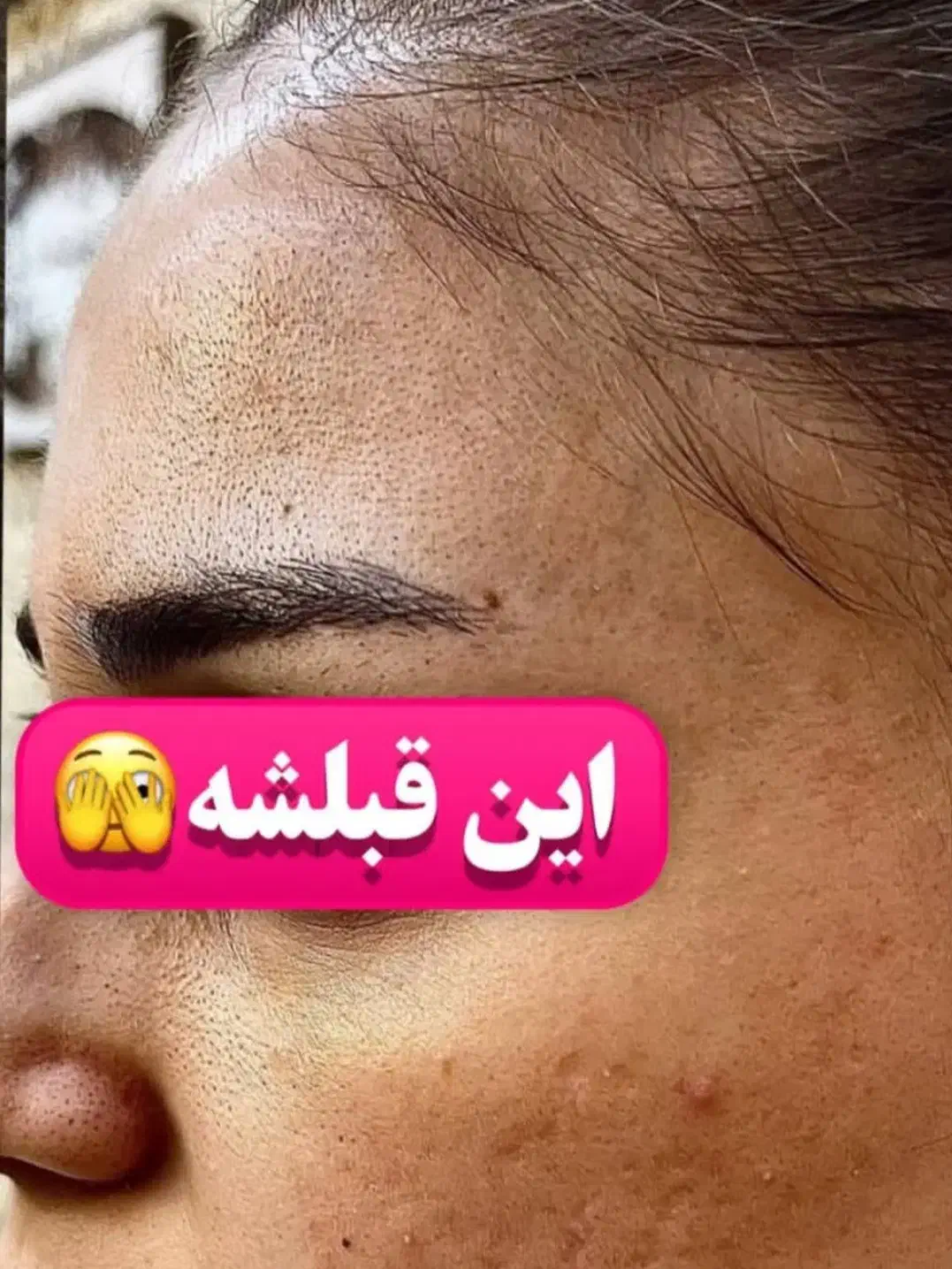 فیشیال وپاکسازی پوست ویژه بانوان|خدمات آرایشگری و زیبایی|سقز, |دیوار