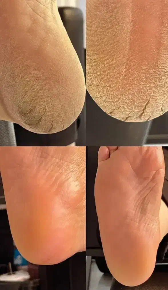 پدیکورتخصصی350آموزش پدیکور پاکسازی دست نوبهار|خدمات آرایشگری و زیبایی|کرمانشاه, |دیوار