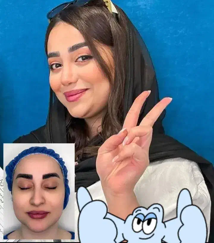 مرکزفوق تخصصی جراحی بینی/وجشنواره۱۰روزهشگفت انگیز|خدمات آرایشگری و زیبایی|مشهد, احمدآباد|دیوار