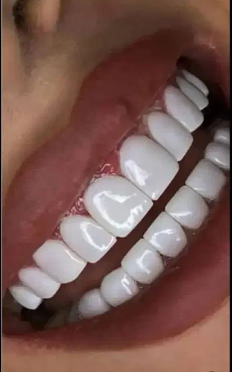 کلینیک دندانپزشکی نیکان|خدمات آرایشگری و زیبایی|تهران, شهرک ابوذر|دیوار