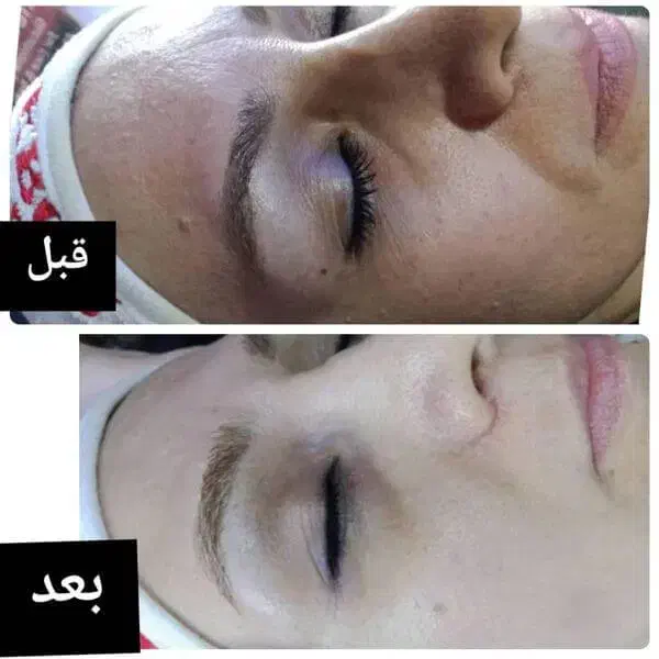 فیشال تخصصی و پاکسازی|خدمات آرایشگری و زیبایی|اصفهان, کوجان|دیوار