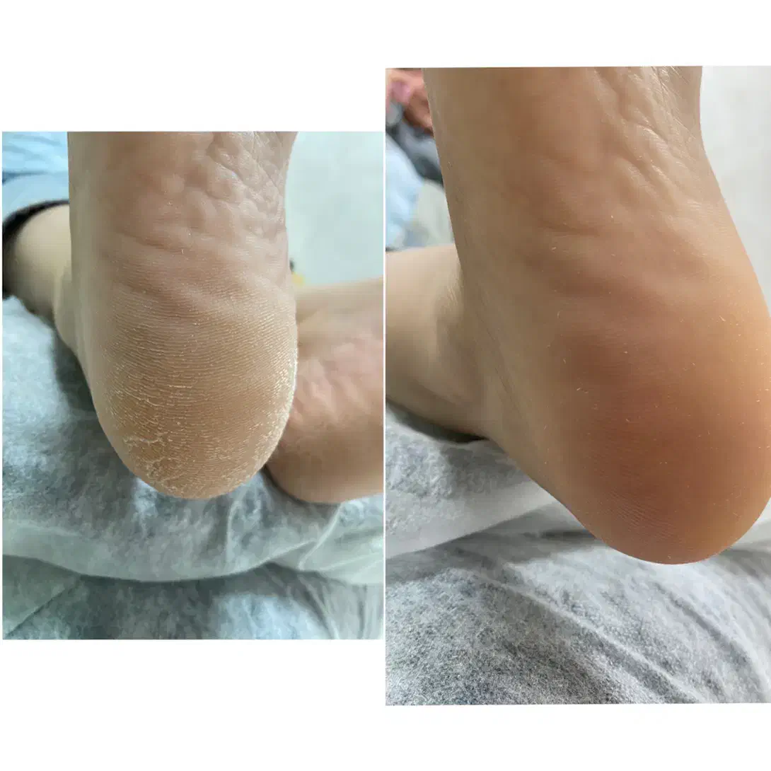 پدیکور تخصصی|خدمات آرایشگری و زیبایی|برازجان, |دیوار