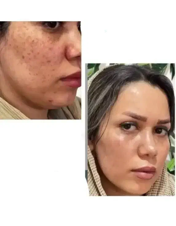 پاکسازی کبد فقط در ۴۰ روز|خدمات آرایشگری و زیبایی|گنبد کاووس, |دیوار