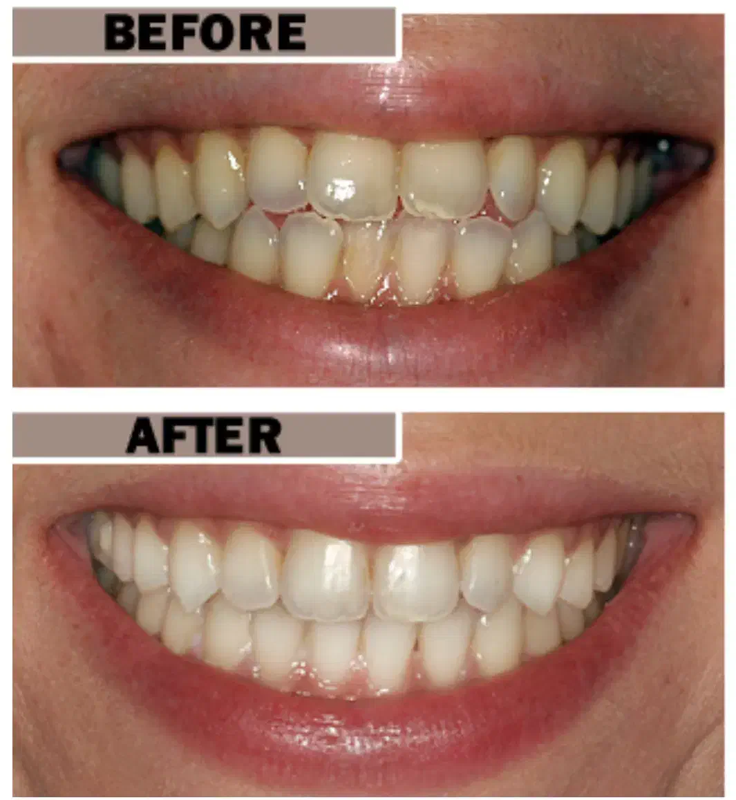 خدمات دندانپزشکی تاکستان ( آفر ویژه )|خدمات آرایشگری و زیبایی|تاکستان, |دیوار