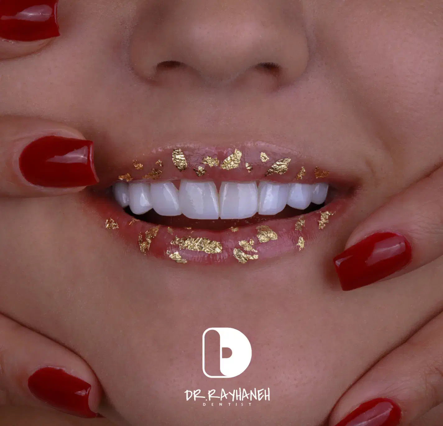 کامپوزیت/لمینت/دندانپزشکی|خدمات آرایشگری و زیبایی|مشهد, کوثر|دیوار