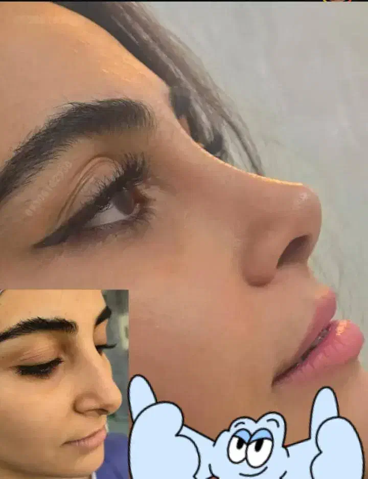 مرکزفوق تخصصی جراحی بینی/وجشنواره۱۰روزهشگفت انگیز|خدمات آرایشگری و زیبایی|مشهد, احمدآباد|دیوار